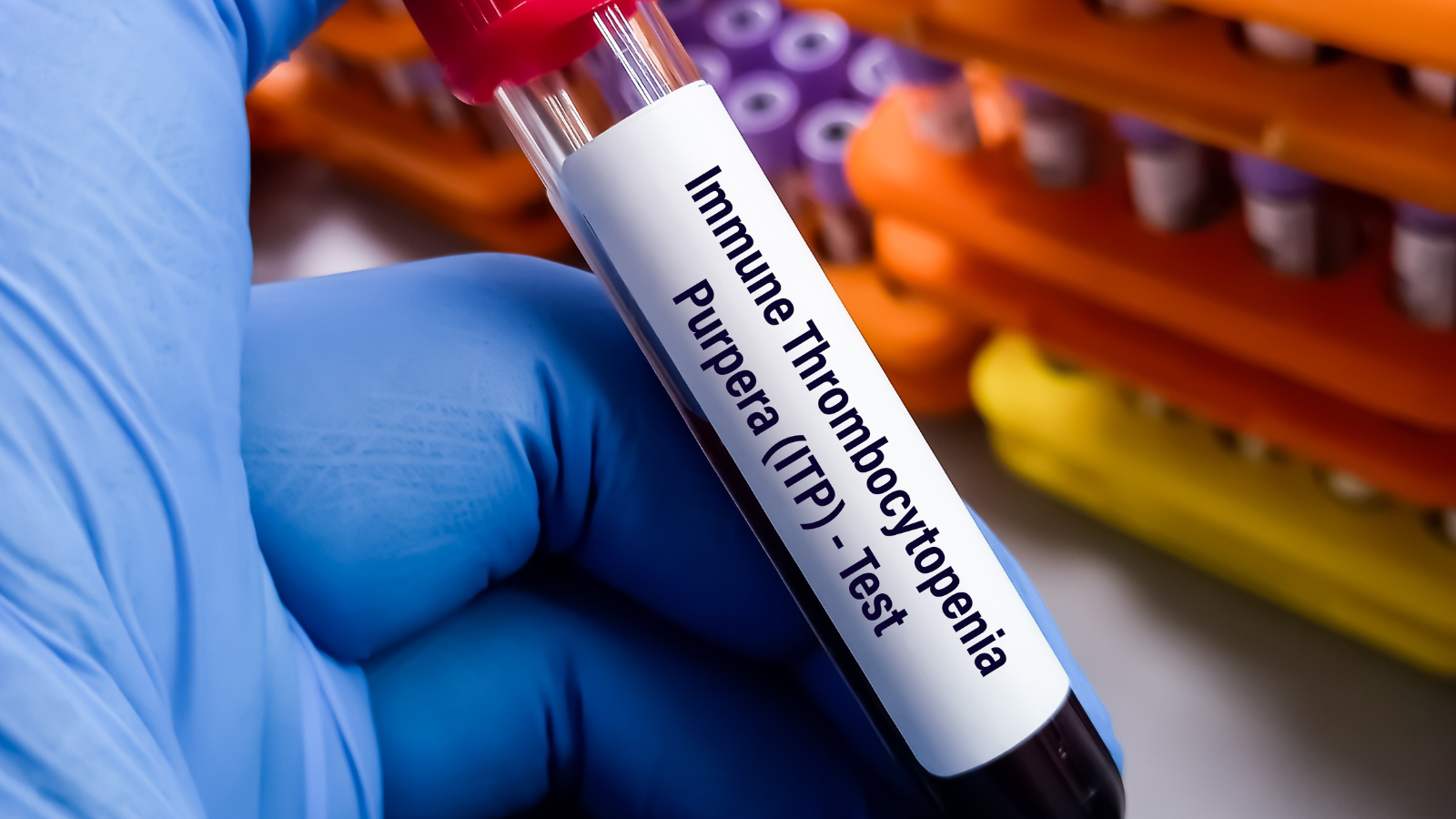 xuat-huyet-giam-tieu-cau 5.png