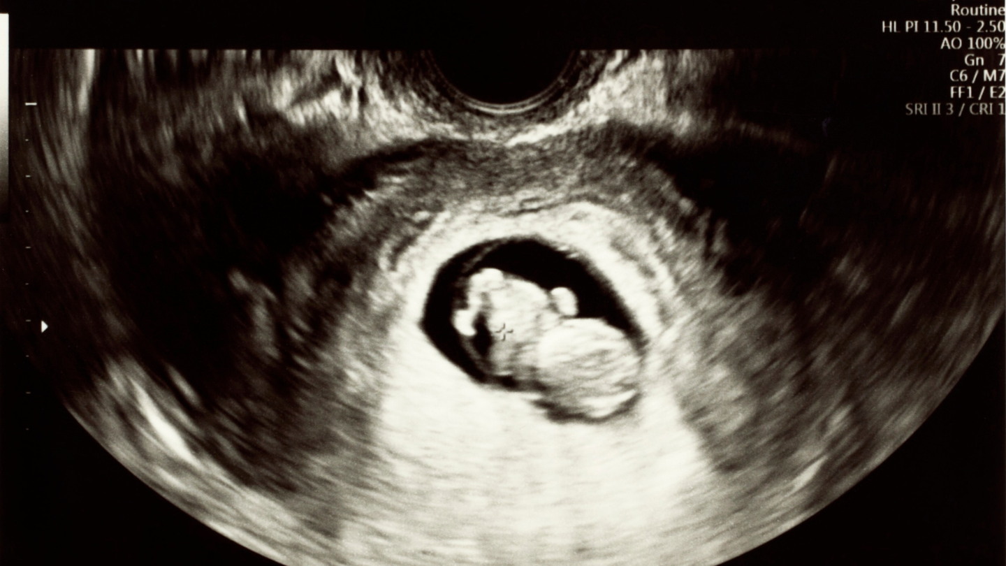 Theo dõi sự phát triển của thai nhi để đảm bảo bé tăng trưởng đúng tuần tuổi và không có bất thường trong suốt thai kỳ