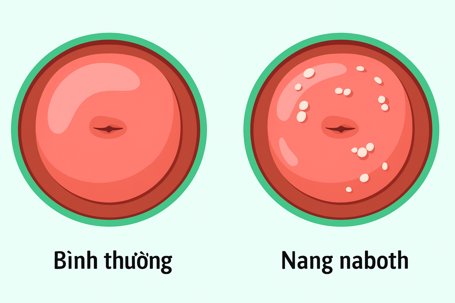 Cổ tử cung bình thường có bề mặt phẳng, trong khi cổ tử cung có nang Naboth thường thấy nhiều hạt trắng hoặc vàng nhỏ