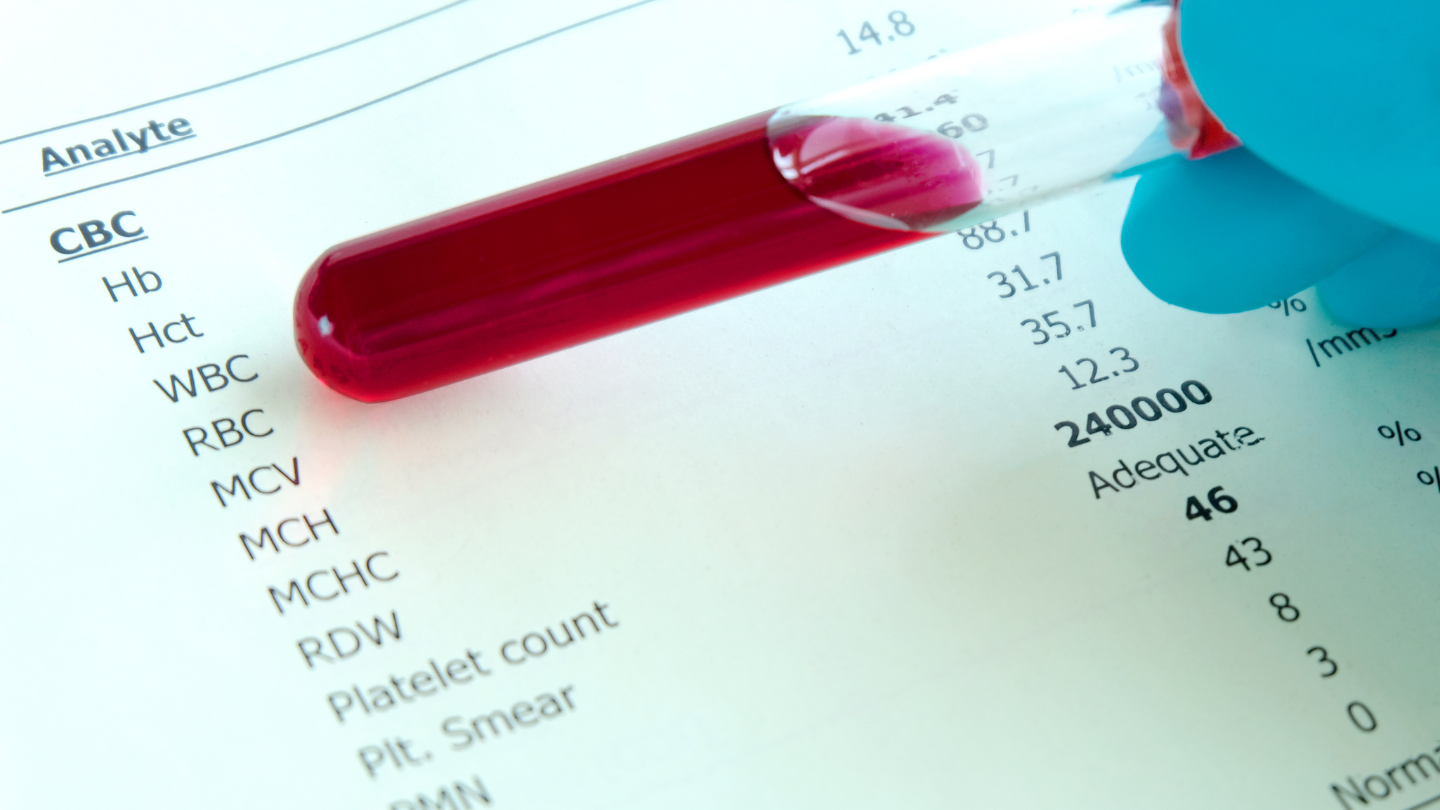 Xét nghiệm máu giúp đánh giá chỉ số bạch cầu lympho trong máu