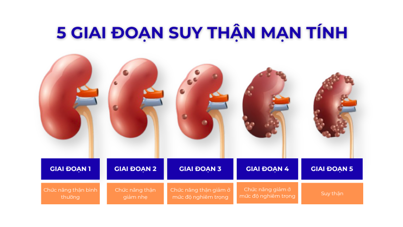 5 phân độ suy thận mạn: Dấu hiệu và cách điều trị 1