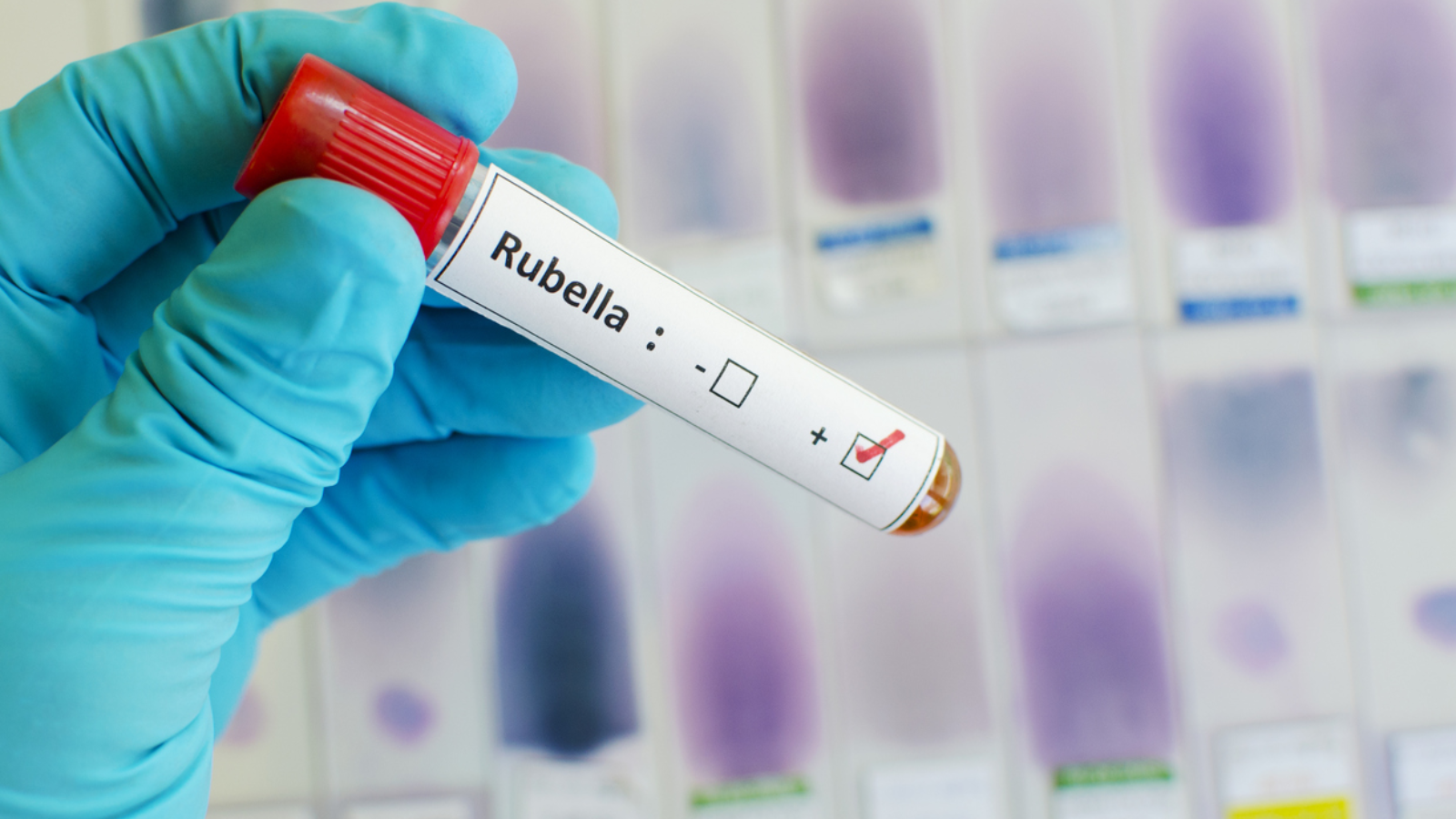 benh-rubella-o-phu-nu-mang-thai 6.png