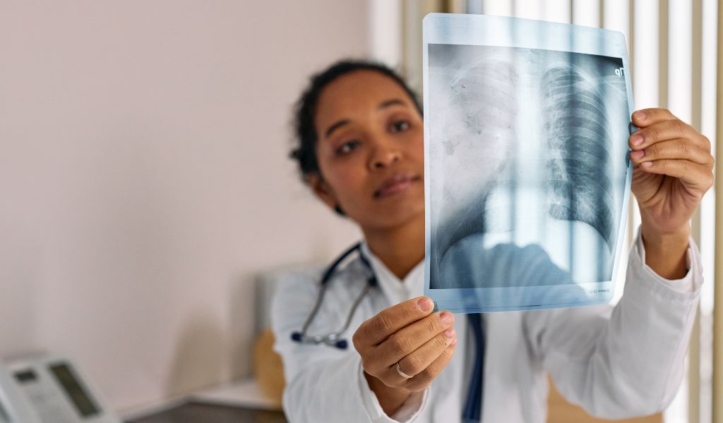 Bệnh lý tại phổi và màng phổi là nguyên nhân phổ biến khiến nhiều người bị đau phổi