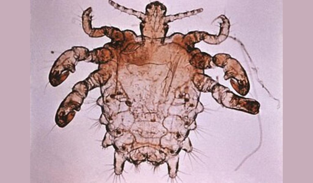 Rận mu có tự hết không? Thực tế rận mu không thể tự biến mất nếu không điều trị