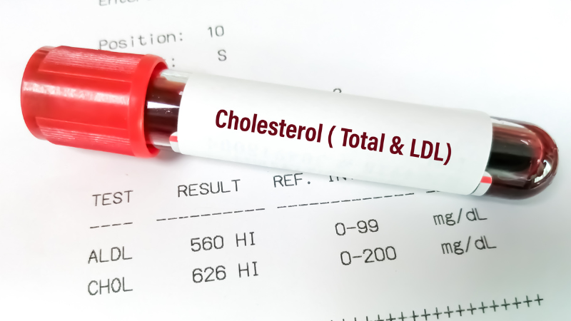 Cholesterol cao nên ăn gì để giảm cholesterol xấu và tăng cholesterol tốt tự nhiên