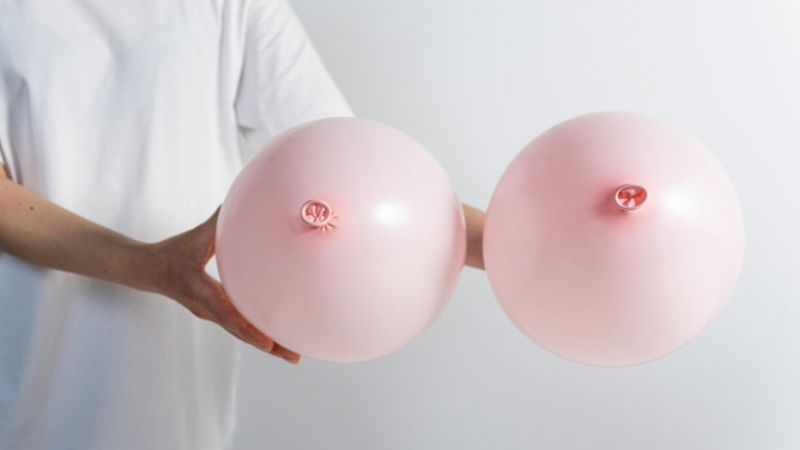 Áo ngực vừa vặn và dưỡng ẩm giúp phòng ngừa đau nhũ hoa