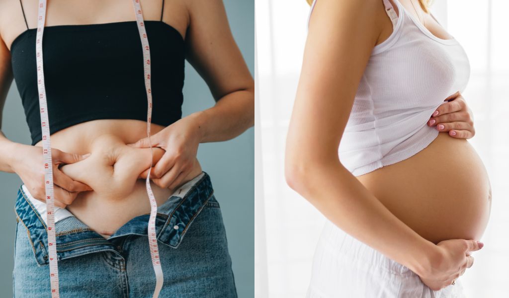 Béo phì và mang thai cũng là một trong những nguyên nhân gây bệnh GERD