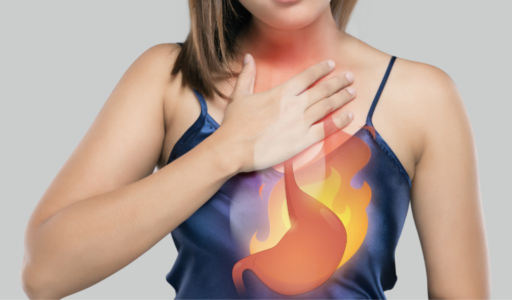 Ợ nóng, ợ chua, nóng rát vùng thượng vị hoặc sau xương ức là triệu chứng điển hình của GERD