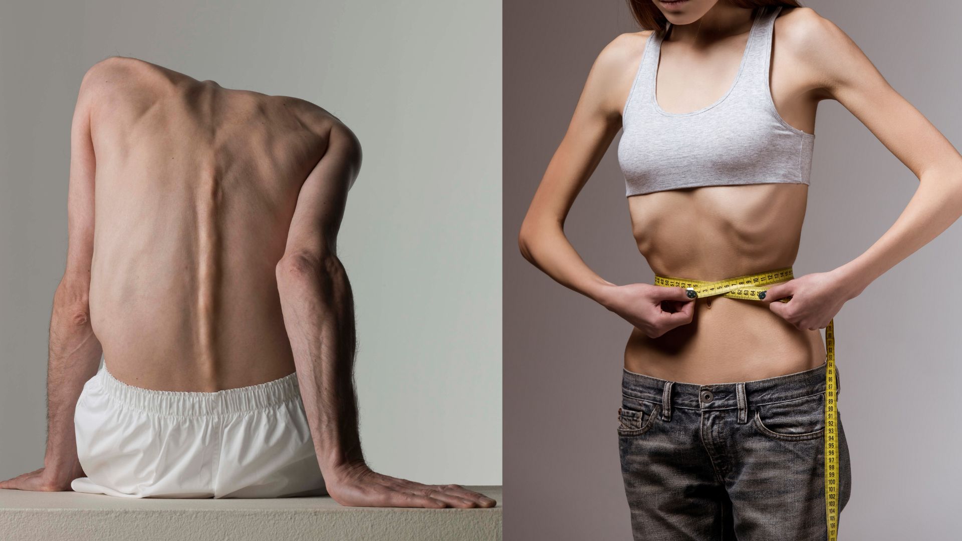 Người bệnh HIV giai đoạn AIDS thường mệt mỏi, suy kiệt và sụt cân nhiều