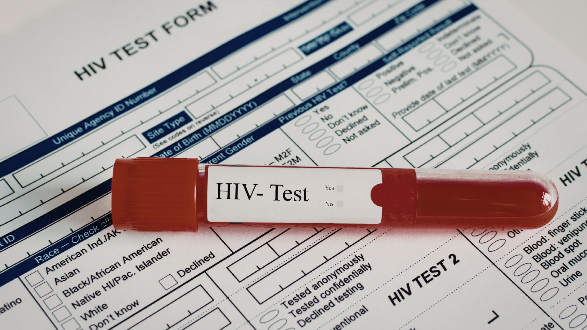 Xét nghiệm huyết thanh học giúp phát hiện kháng thể kháng HIV