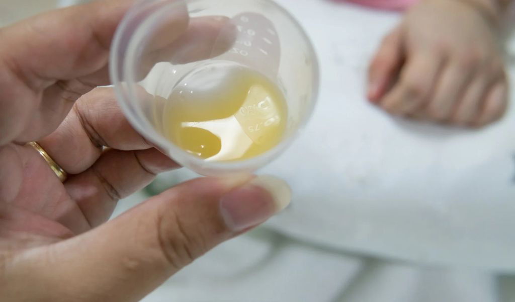 Sữa non có màu vàng nhạt hoặc đậm do chứa hàm lượng beta-carotene cao