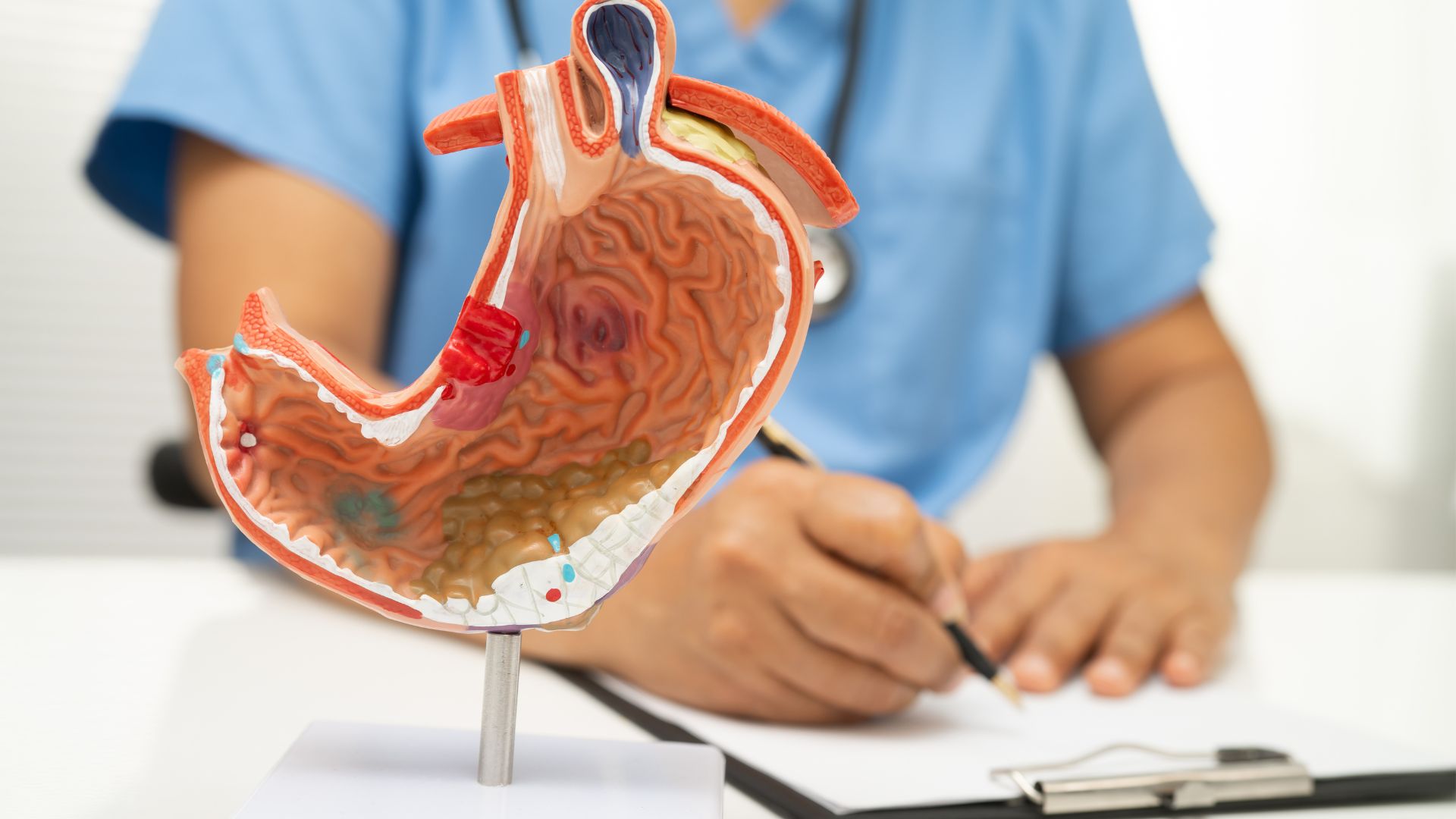 Pepsinogen được tiết ra từ các tế bào tuyến của niêm mạc dạ dày