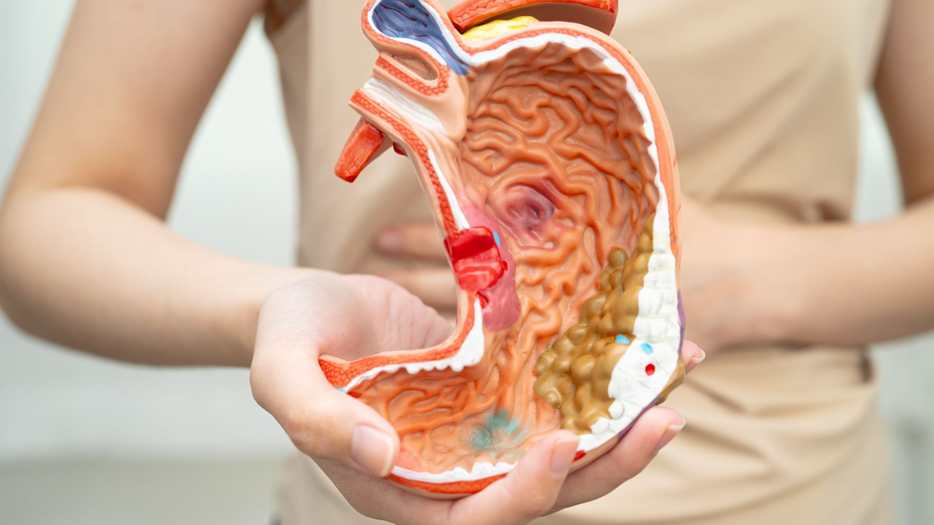 Xét nghiệm pepsinogen giúp nhận diện nhóm người có nguy cơ cao bị ung thư dạ dày