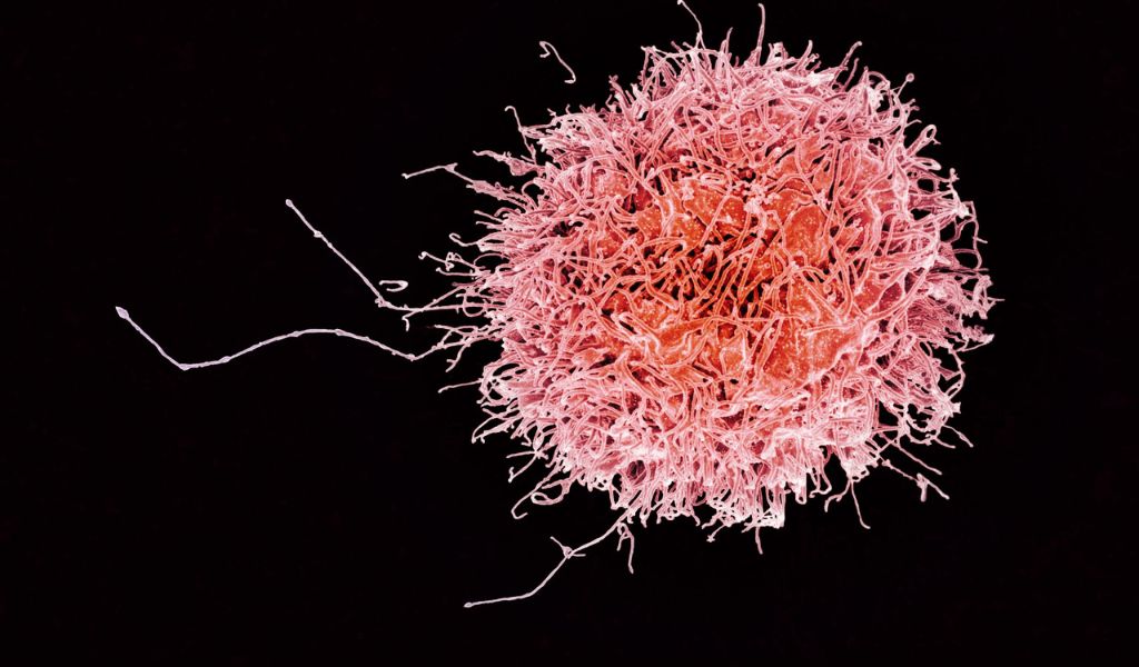 Hình ảnh minh họa tế bào NK trong cơ thể người