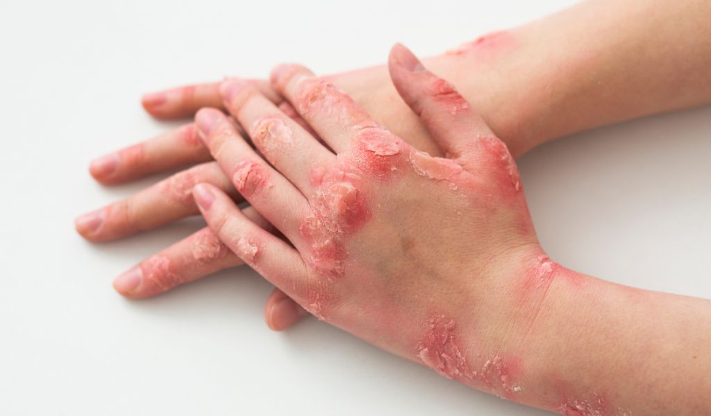 Tạo mô thay thế cho mô tổn thương là một trong những ứng dụng của tế bào gốc