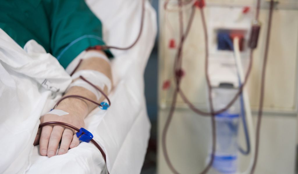 Suy thận cấp là biến chứng nghiêm trọng do tiêu cơ vân gây ra