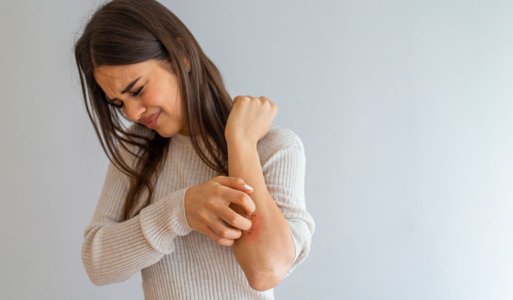 “Bệnh vảy nến có tự hết không?” là điều khiến nhiều người băn khoăn