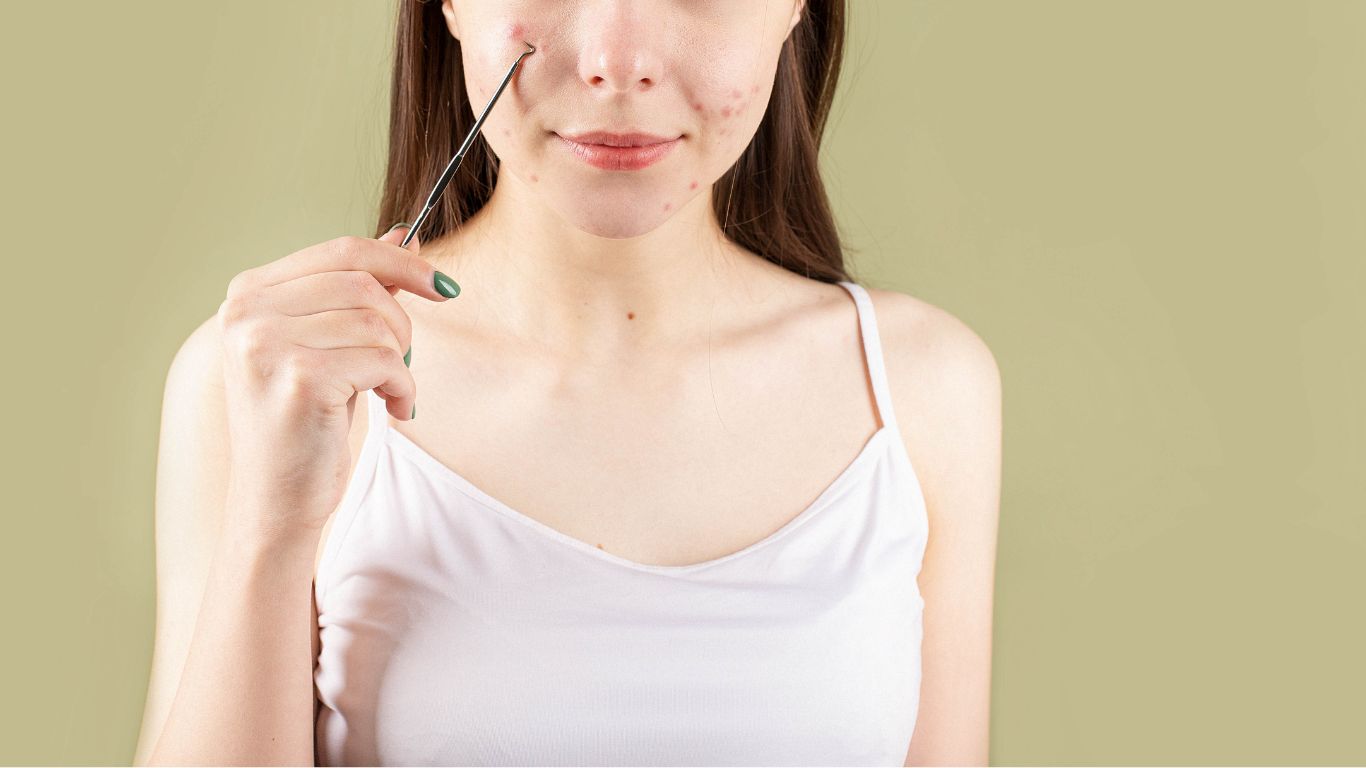 Nổi mụn nội tiết nên uống gì? Các thực phẩm giúp giảm tình trạng mụn nội tiết 3