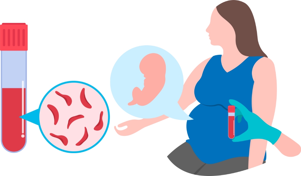 Xét nghiệm gen thalassemia giúp phát hiện sớm người mang gen, phòng ngừa sinh con mắc bệnh