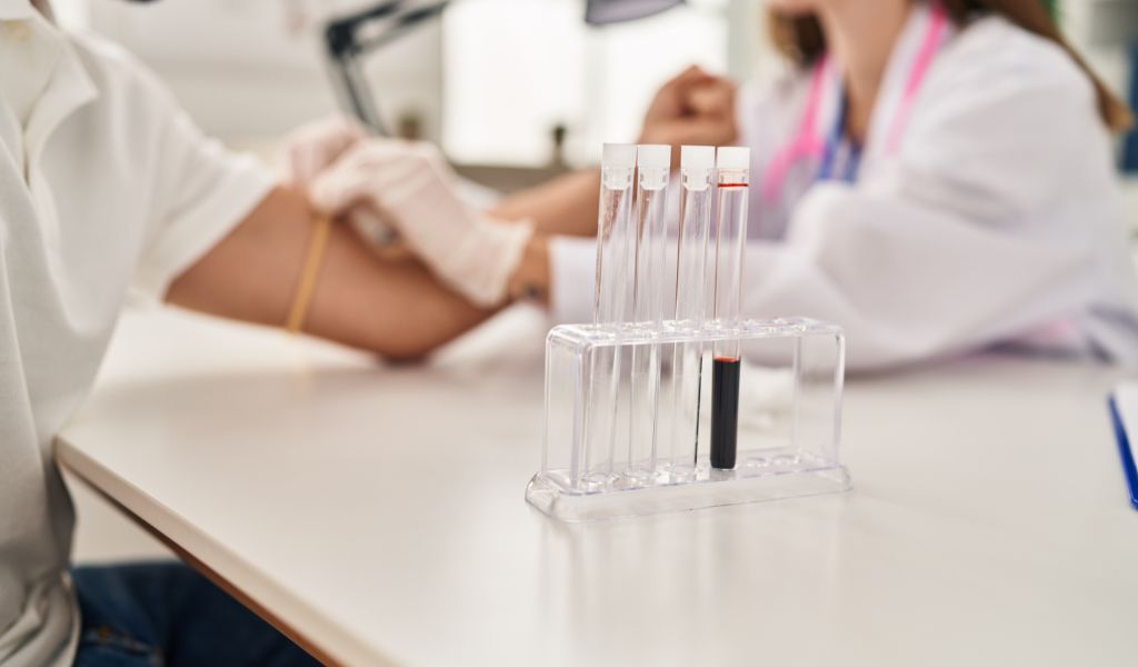 Nên thực hiện xét nghiệm tại cơ sở y tế uy tín và đảm bảo chất lượng