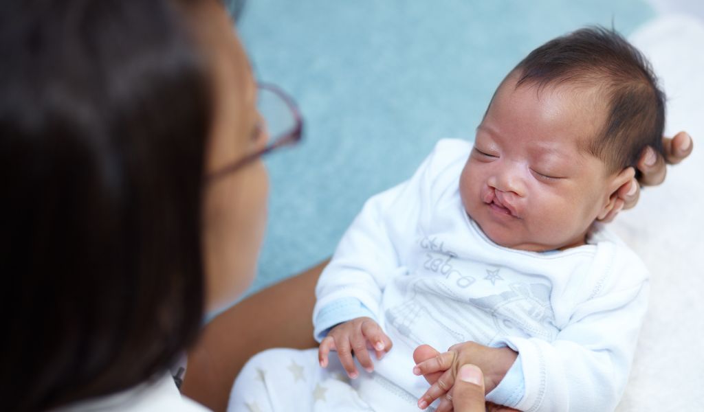 Người mắc dị tật bẩm sinh như hở hàm ếch nên xét nghiệm gen trước khi mang thai