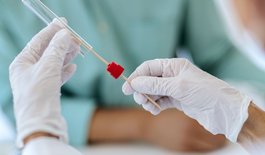 Lấy mẫu tế bào cổ tử cung để quan sát dưới kính hiển vi, giúp phát hiện sớm những thay đổi bất thường