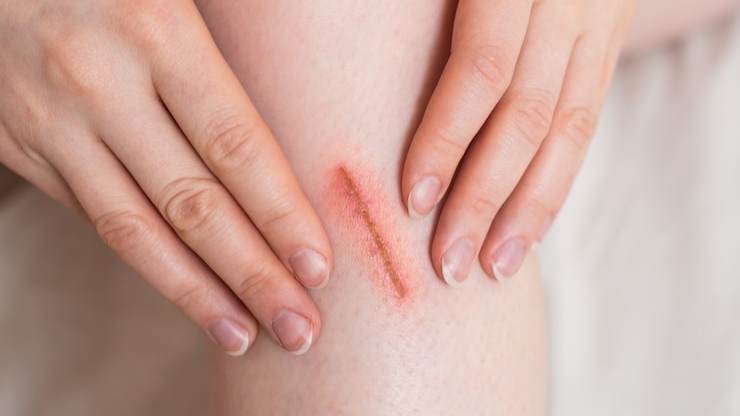 an-gi-mau-lanh-vet-thuong​ 01.png