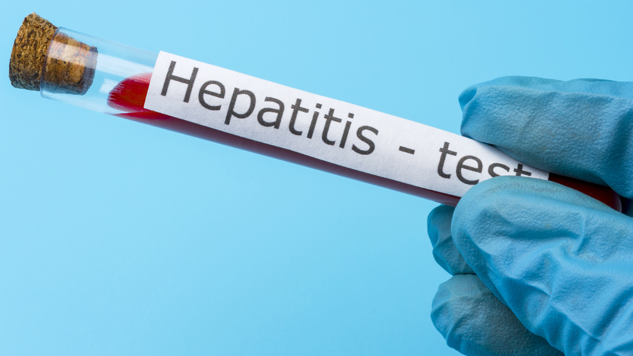 Anti-HBs là gì? Chỉ số Anti-HBs bao nhiêu là bình thường?