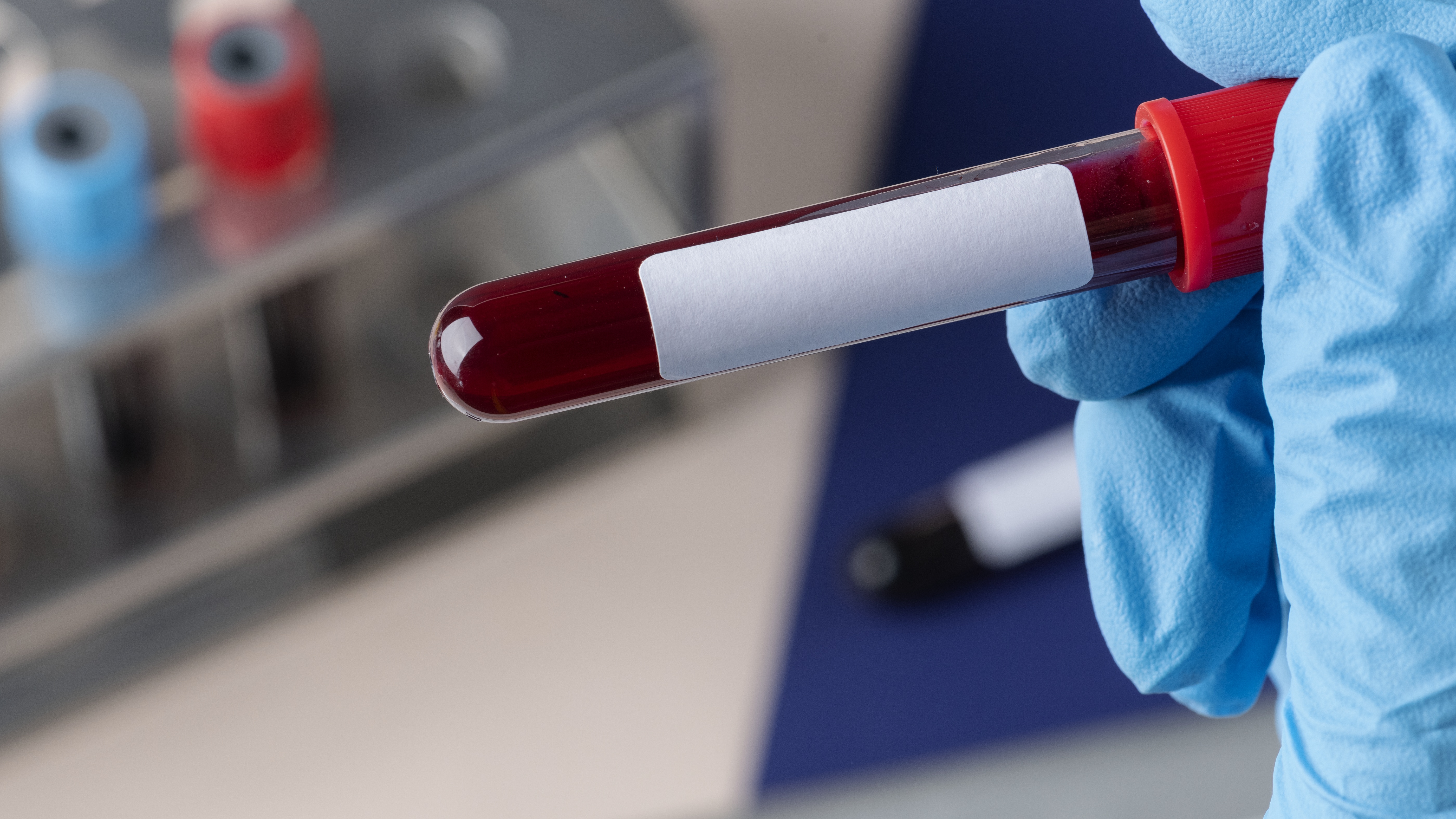 Anti-HBc là kháng thể kháng lại phần lõi của virus viêm gan B