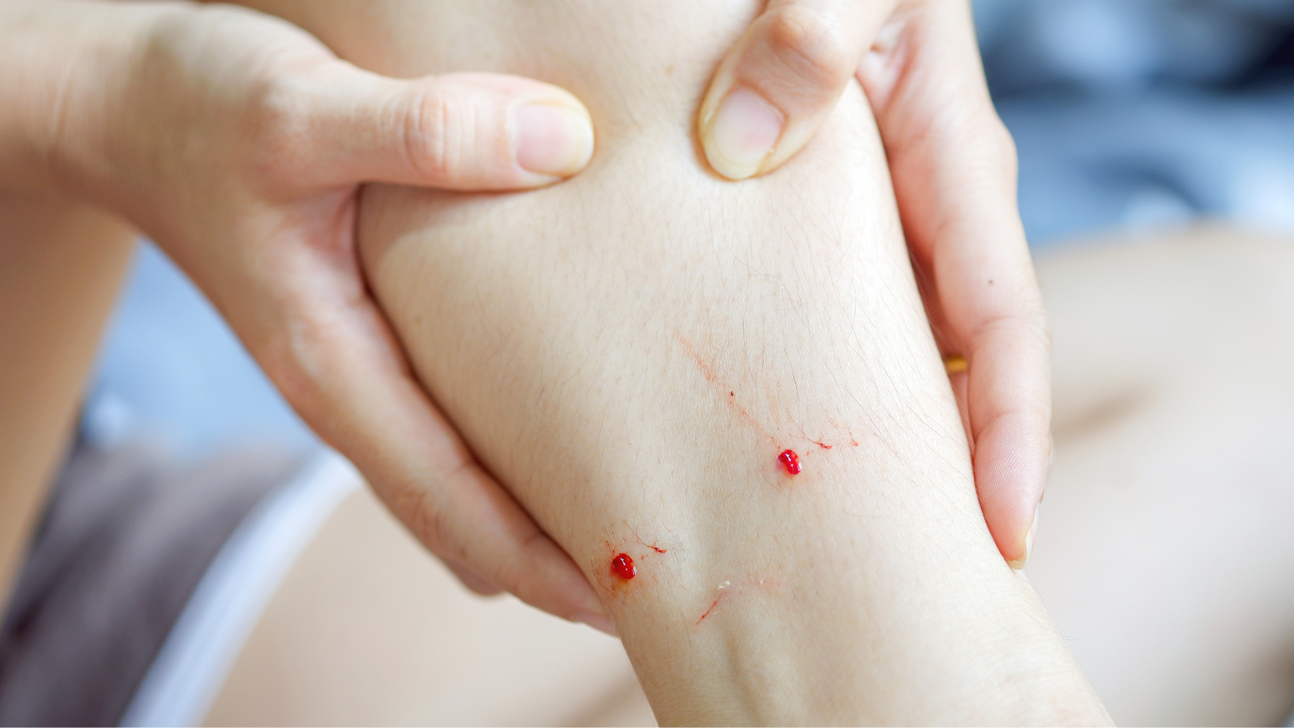 ba-bau-bi-cho-can-co-sao-khong-can-tiem-phong-khong 4.png