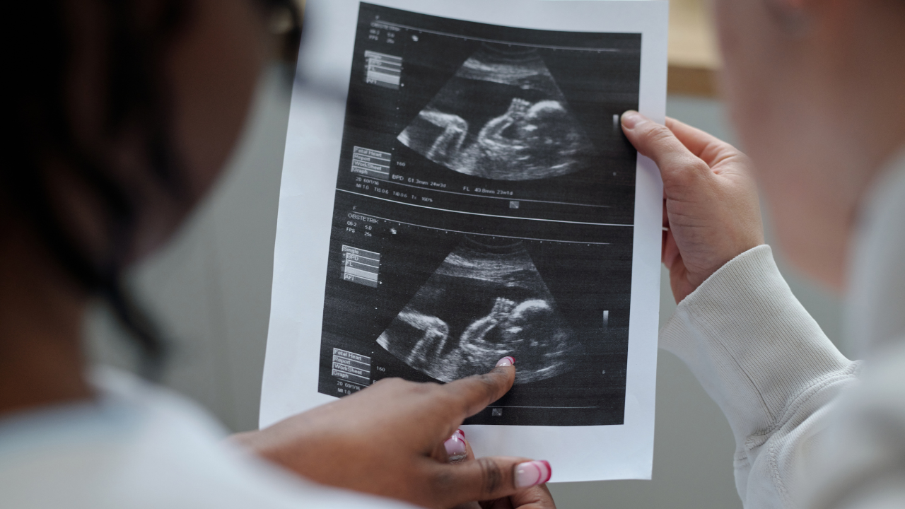 Khi tình trạng sâu răng và viêm nha chu xảy ra, nguy cơ sảy thai hoặc sinh non