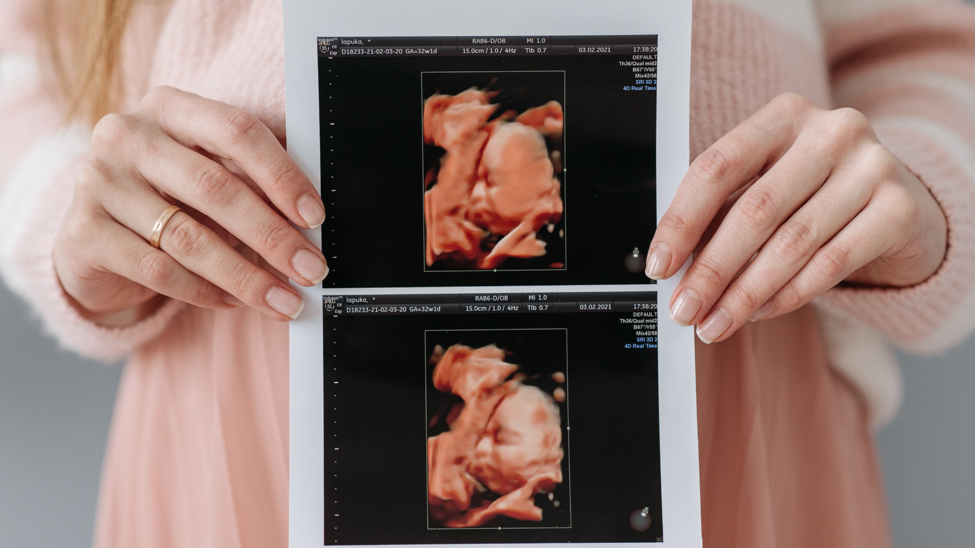 Bà bầu cần làm gì khi thai nhi bị nấc? Giải đáp chi tiết và hướng dẫn xử lý đúng cách4