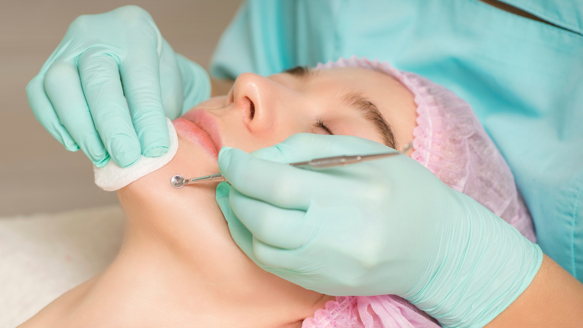 Nên lấy nhân mụn tại phòng khám da liễu hoặc cơ sở có chuyên môn