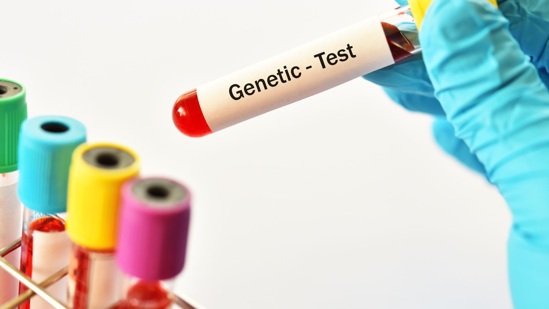 Xét nghiệm di truyền hỗ trợ chẩn đoán bệnh bạch cầu cấp