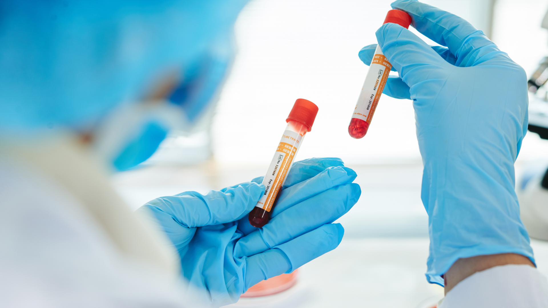 Hiểu rõ ý nghĩa xét nghiệm bạch cầu hạt giúp phát hiện sớm các vấn đề sức khỏe