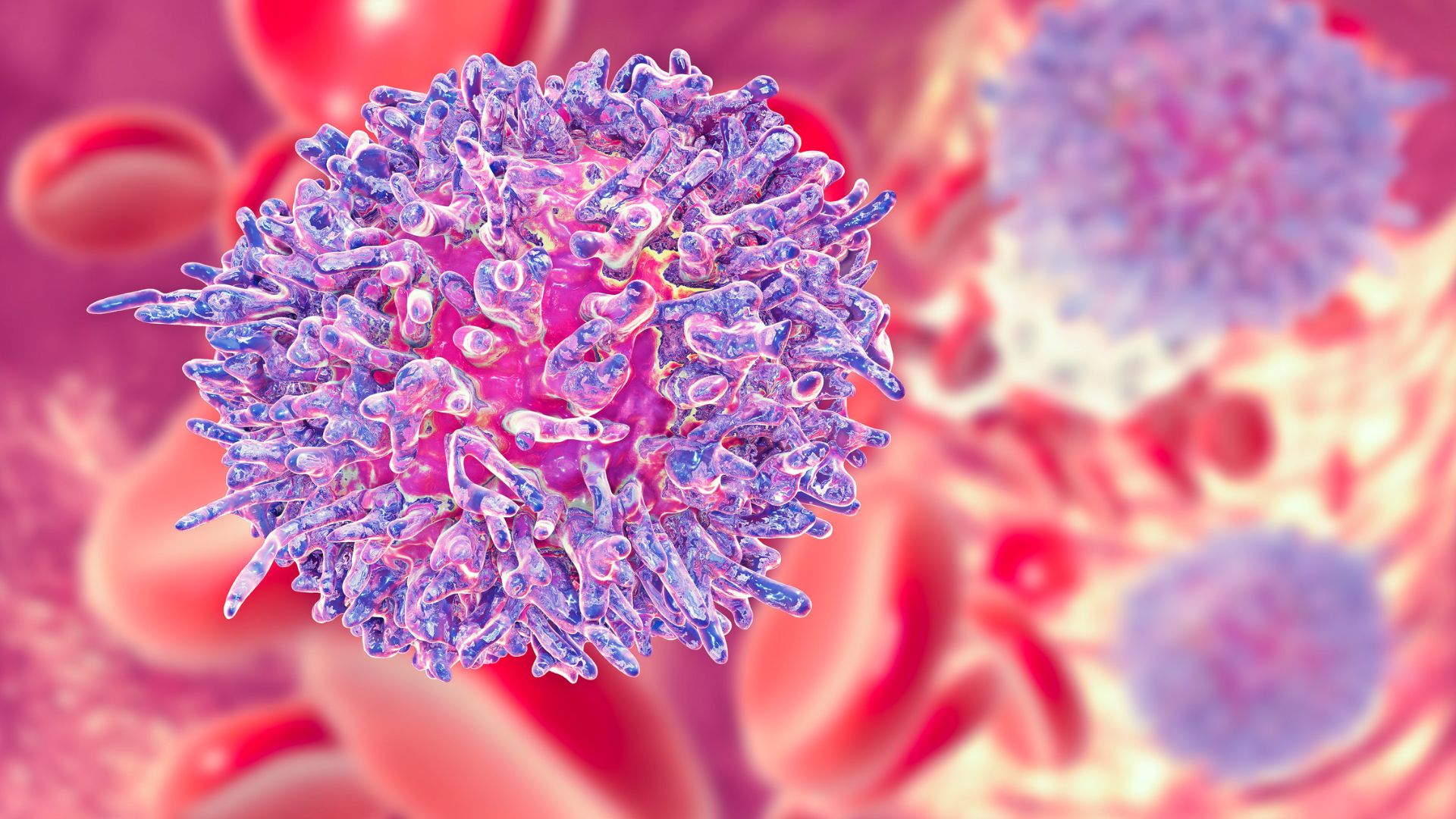 Bạch cầu hạt tăng cao có thể là dấu hiệu của bệnh ung thư máu