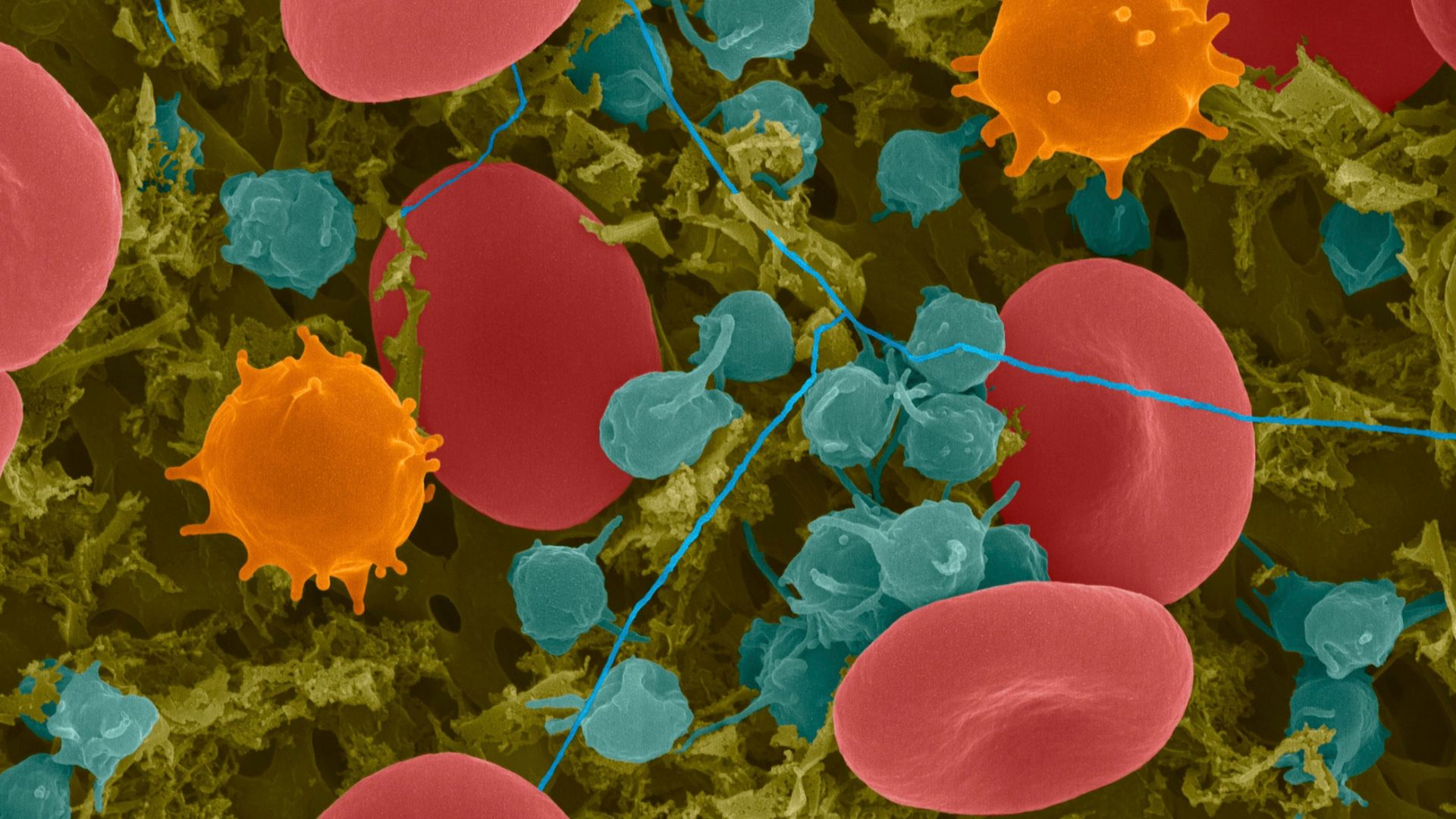 Bạch cầu mono là một loại bạch cầu đơn nhân trong hệ miễn dịch