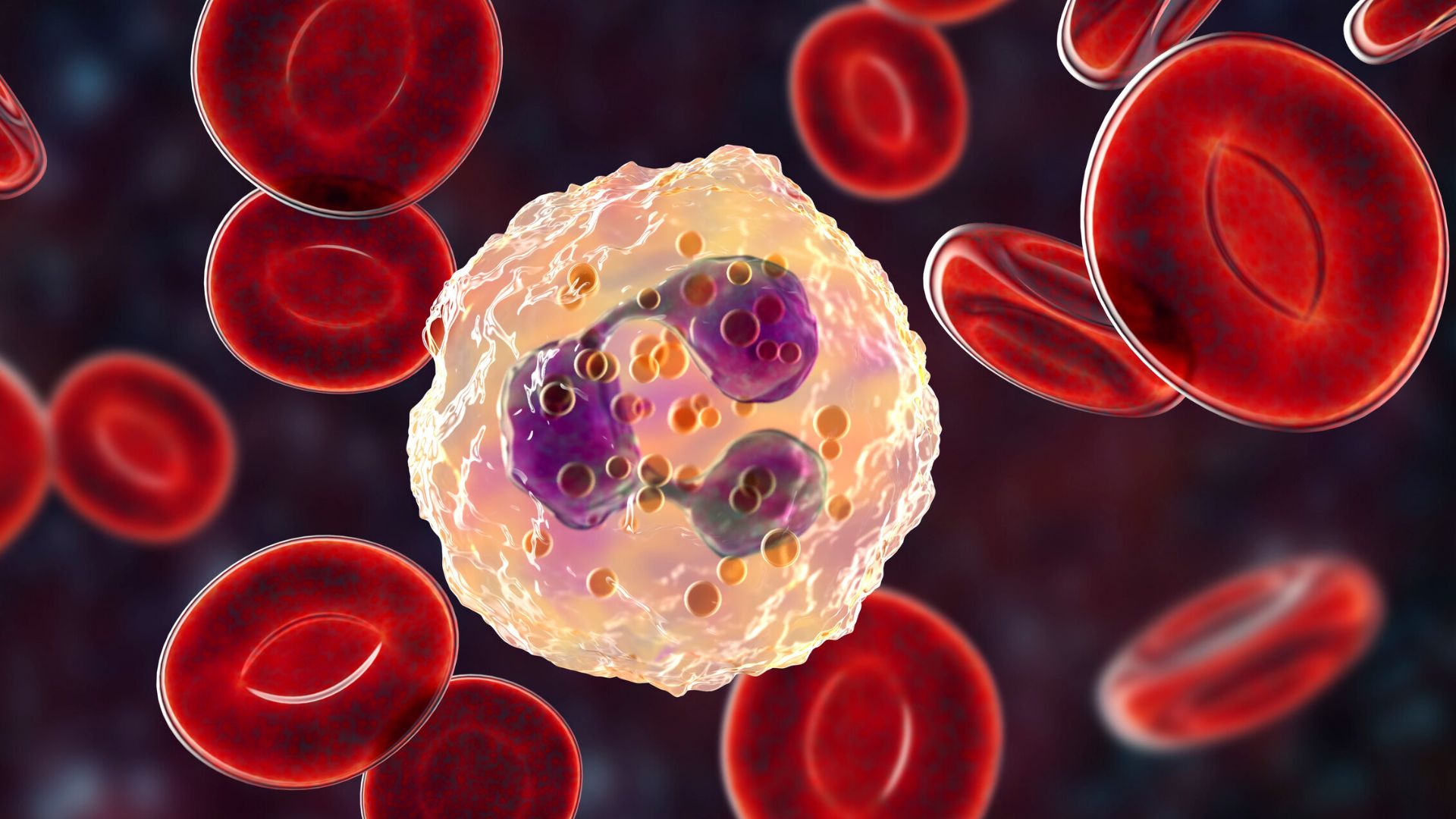 Bạch cầu trung tính càng giảm sâu thì nguy cơ nhiễm khuẩn càng cao