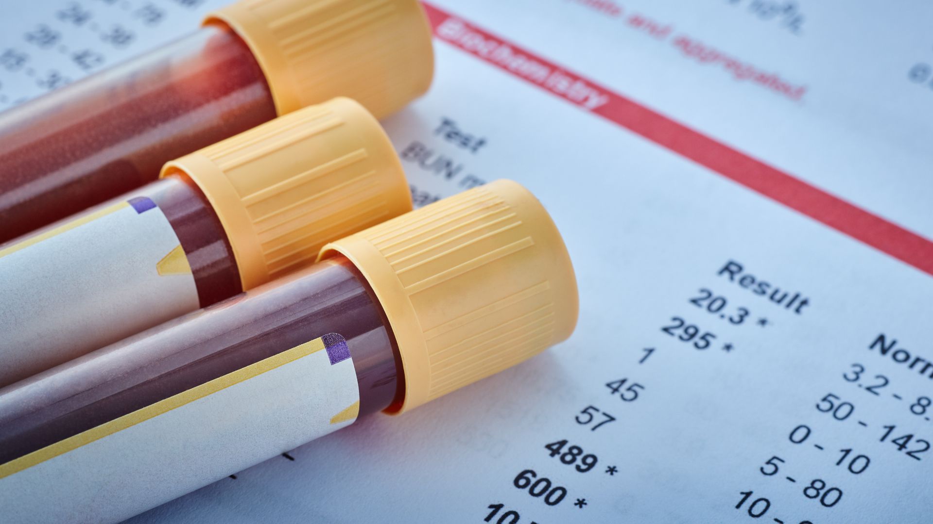 Xét nghiệm máu giúp kiểm tra được số lượng bạch cầu trung tính trong máu