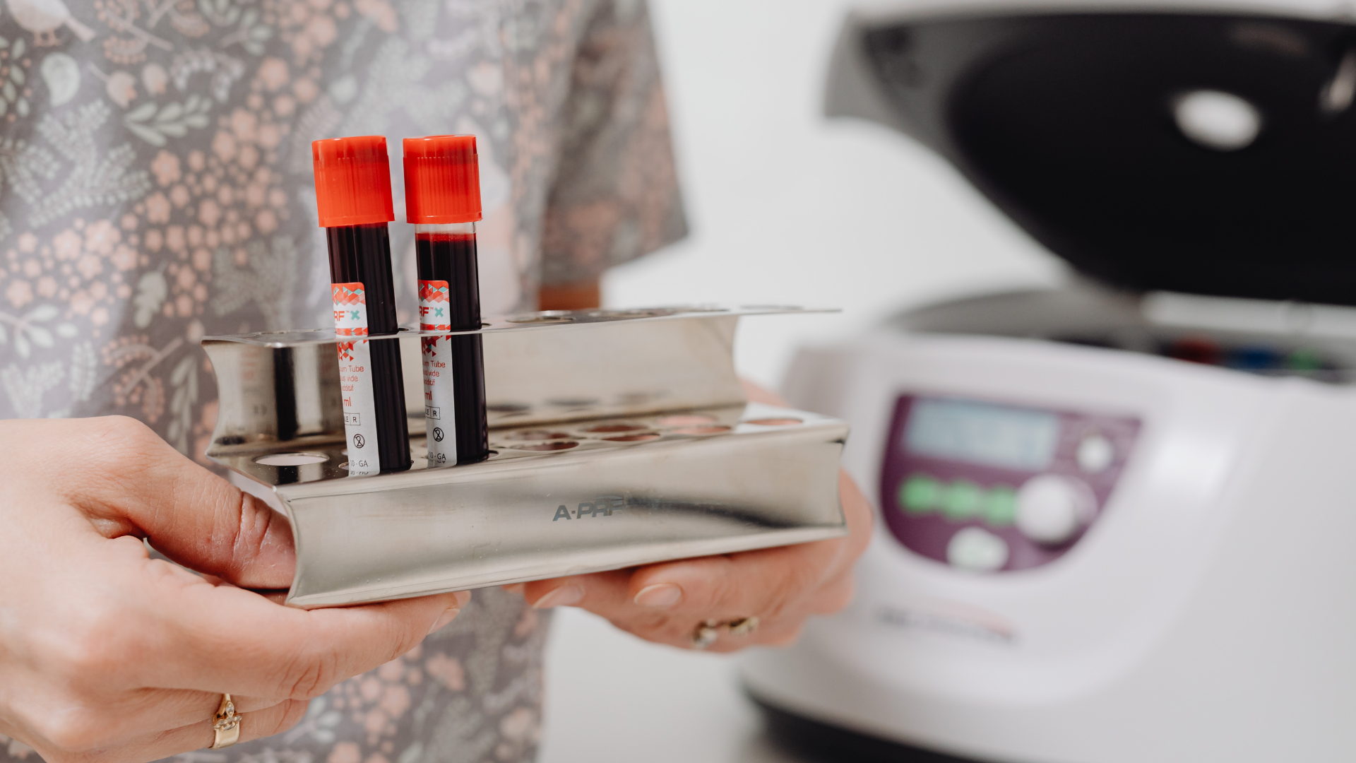 Trong các xét nghiệm máu định kỳ, bạch cầu trung tính tăng là thông tin được bác sĩ đặc biệt lưu ý