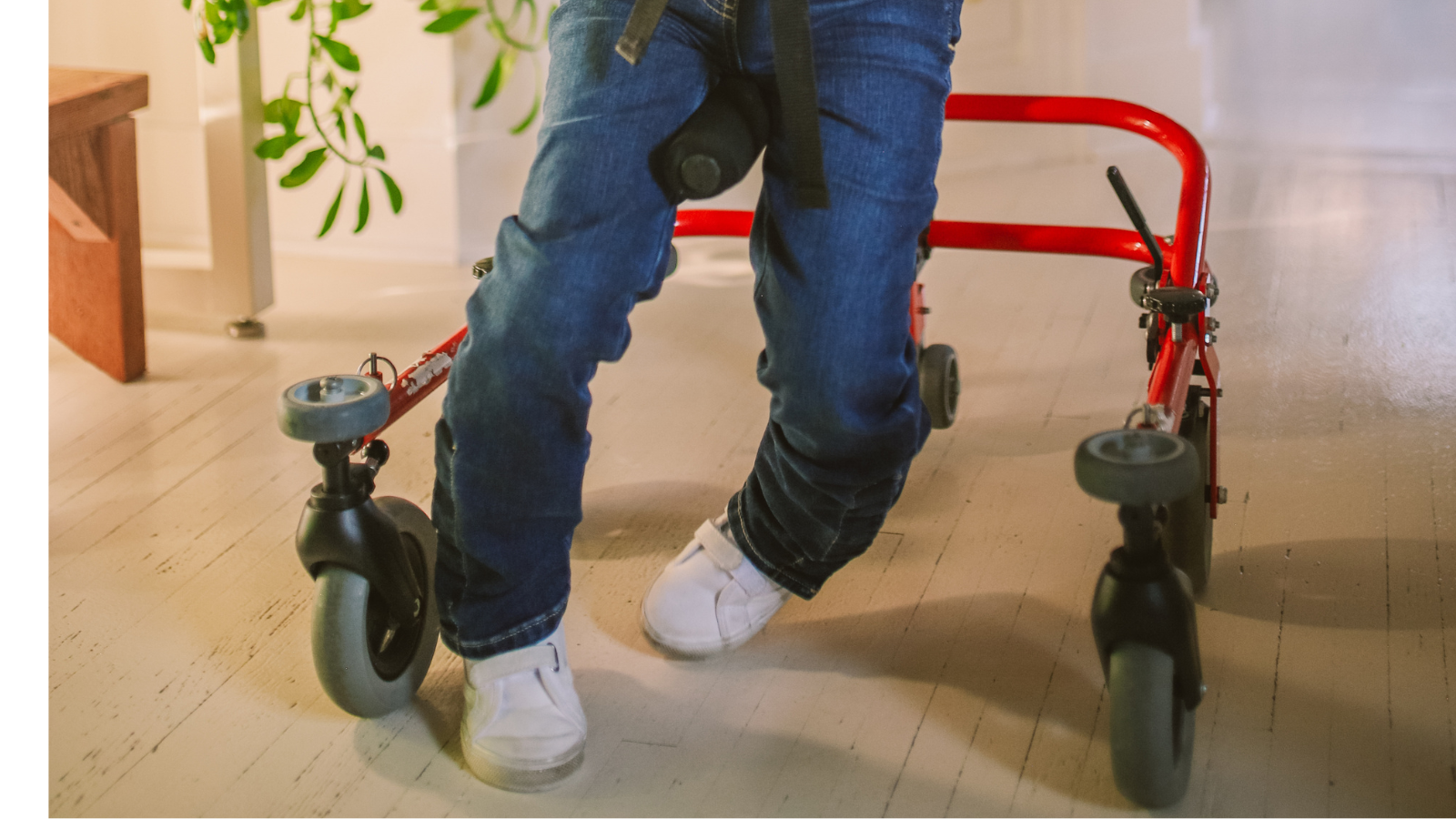 Vật lý trị liệu đóng vai trò nền tảng trong kiểm soát co cứng cơ ở trẻ bại não