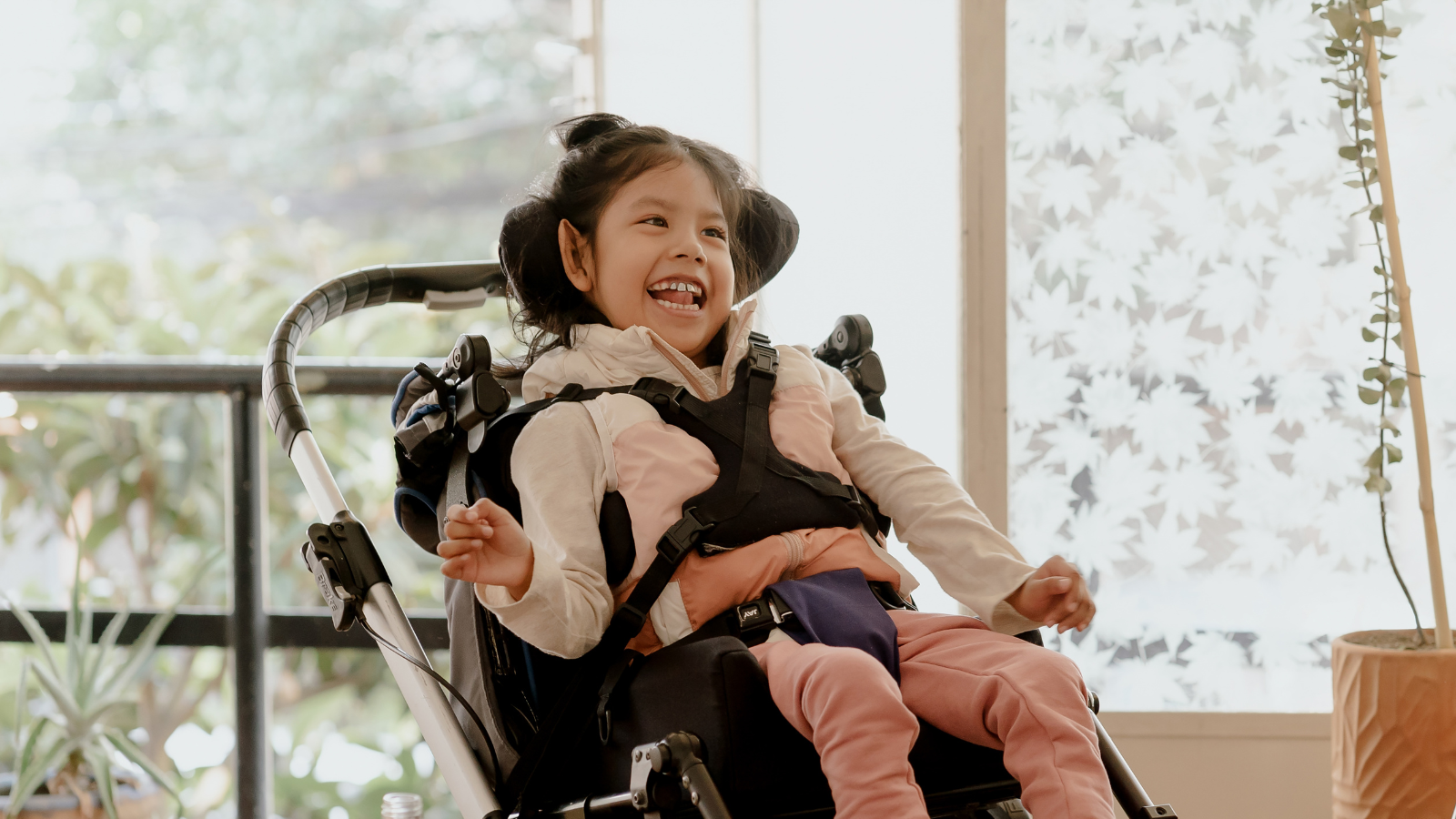 Can thiệp sớm giúp hạn chế biến dạng xương khớp ở trẻ bại não thể co cứng