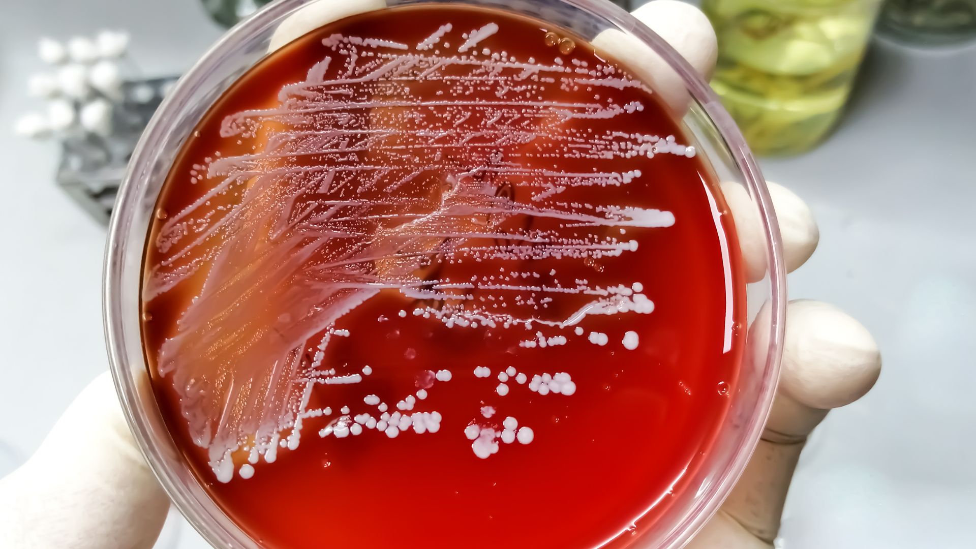 Vi khuẩn Staphylococcus aureus và Streptococcus pyogenes là nguyên nhân gây bệnh ban đỏ nhiễm khuẩn