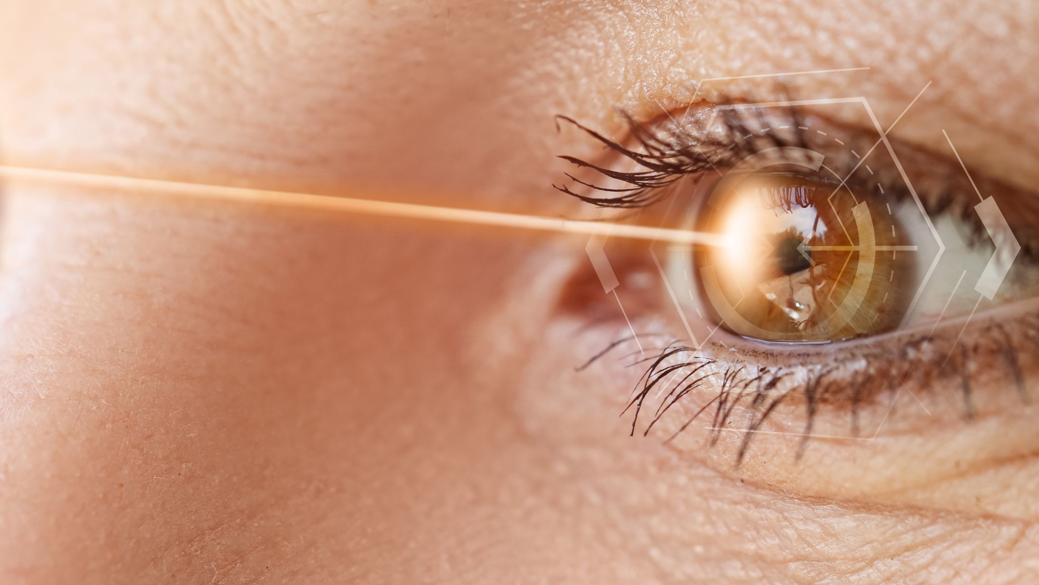 Bắn tia laser trị cận thị bao nhiêu tiền?