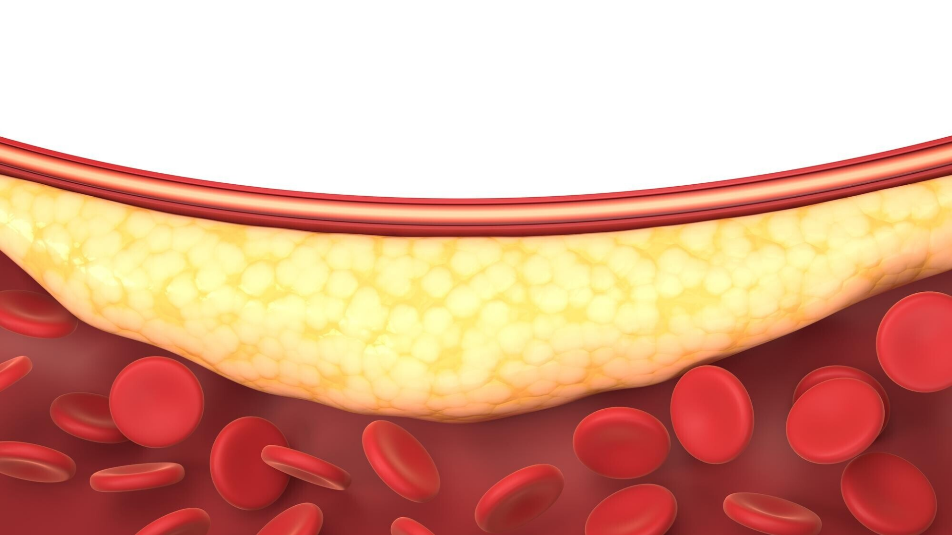Bạn nên theo dõi thêm chỉ số HbA1C để biết đường huyết trung bình trong 2 đến 3 tháng gần nhất