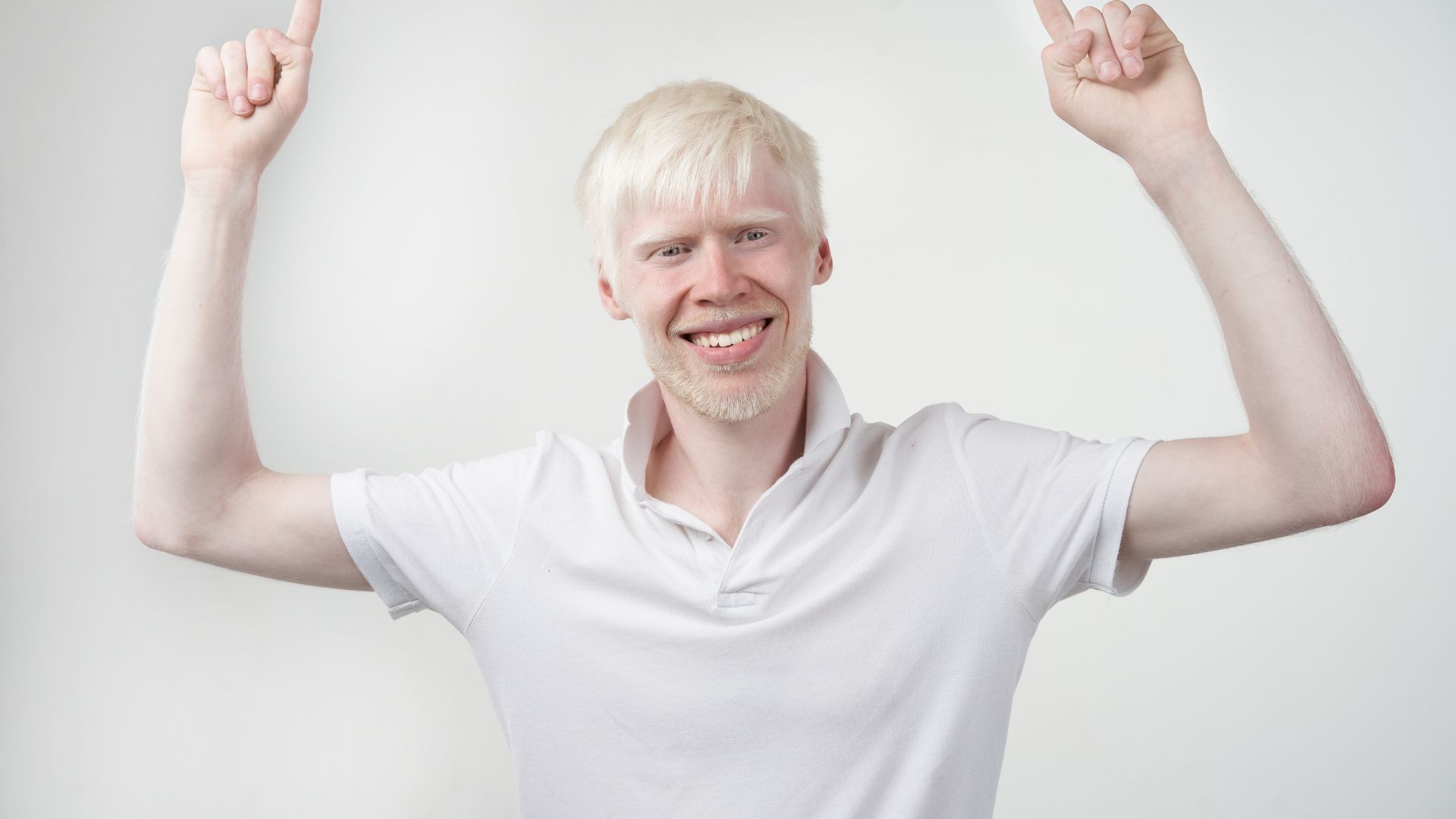 Người mắc bệnh bạch tạng hoàn toàn có thể sống khỏe mạnh bình thường