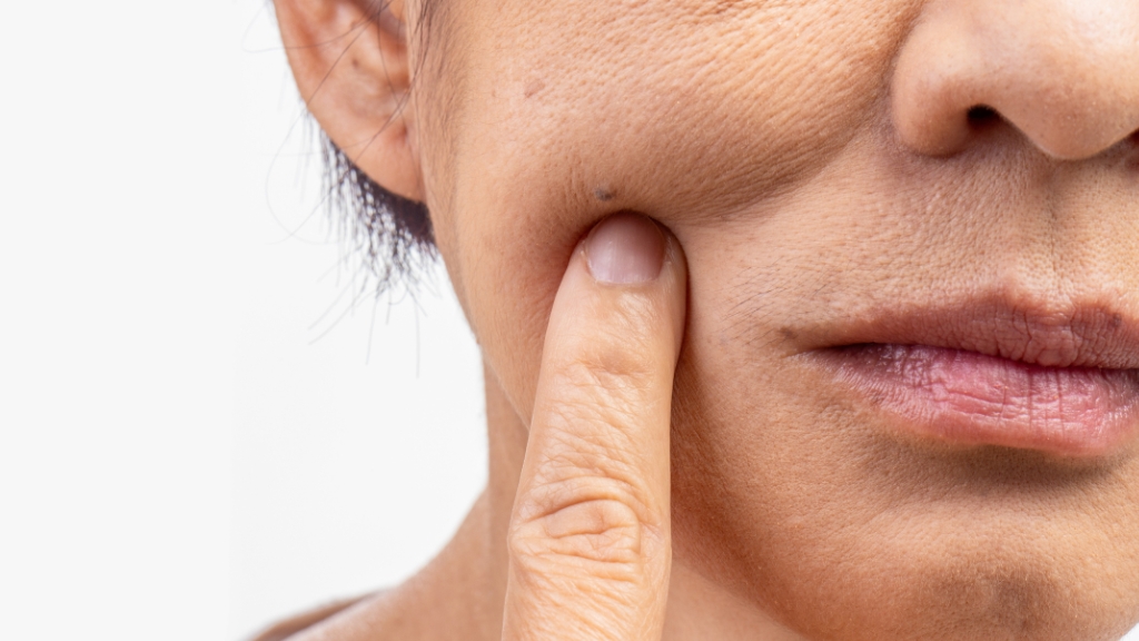 Sau 25 tuổi, da bắt đầu lộ rõ nếp nhăn, kém đàn hồi và dễ khô ráp