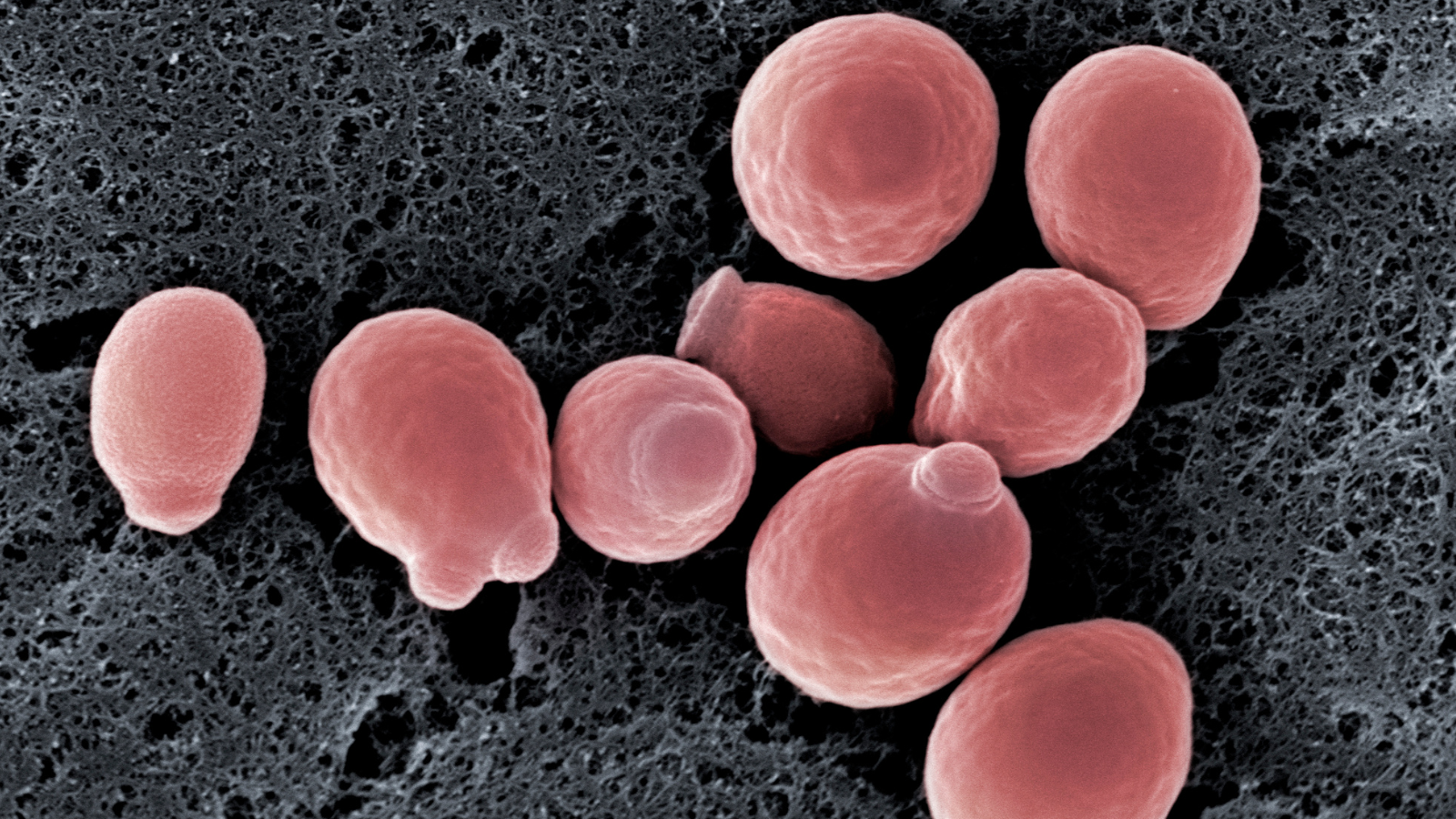 Nhiễm nấm men là một trong những nguyên nhân