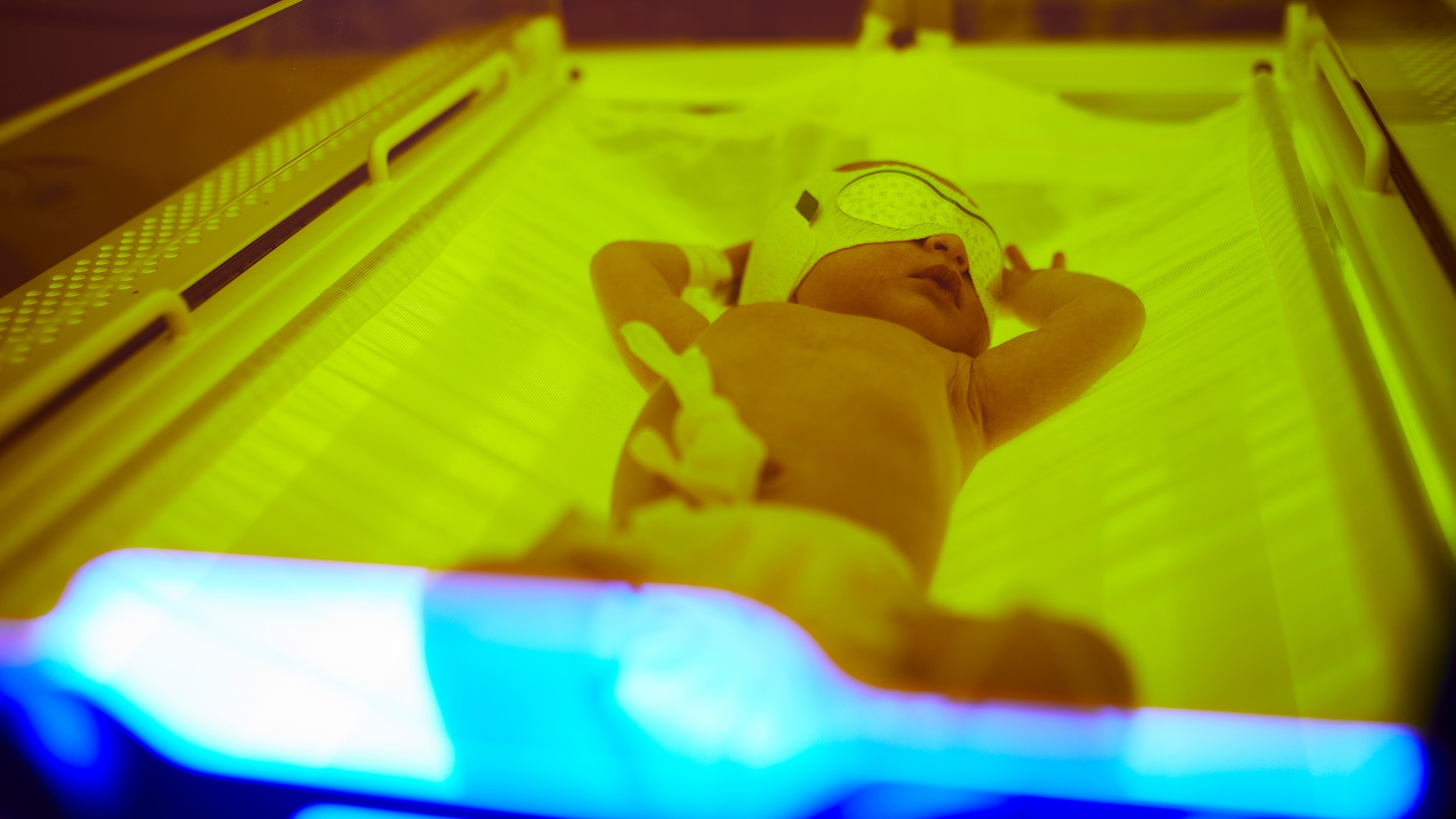 Chiếu đèn có thể được áp dụng để trị vàng da cho trẻ, giúp chuyển hóa bilirubin thành dạng dễ đào thải
