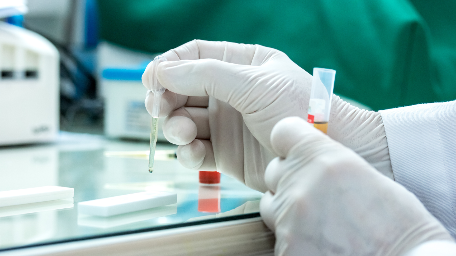 Thời gian trả kết quả có thể dao động từ một đến vài ngày, tùy vào cơ sở thực hiện